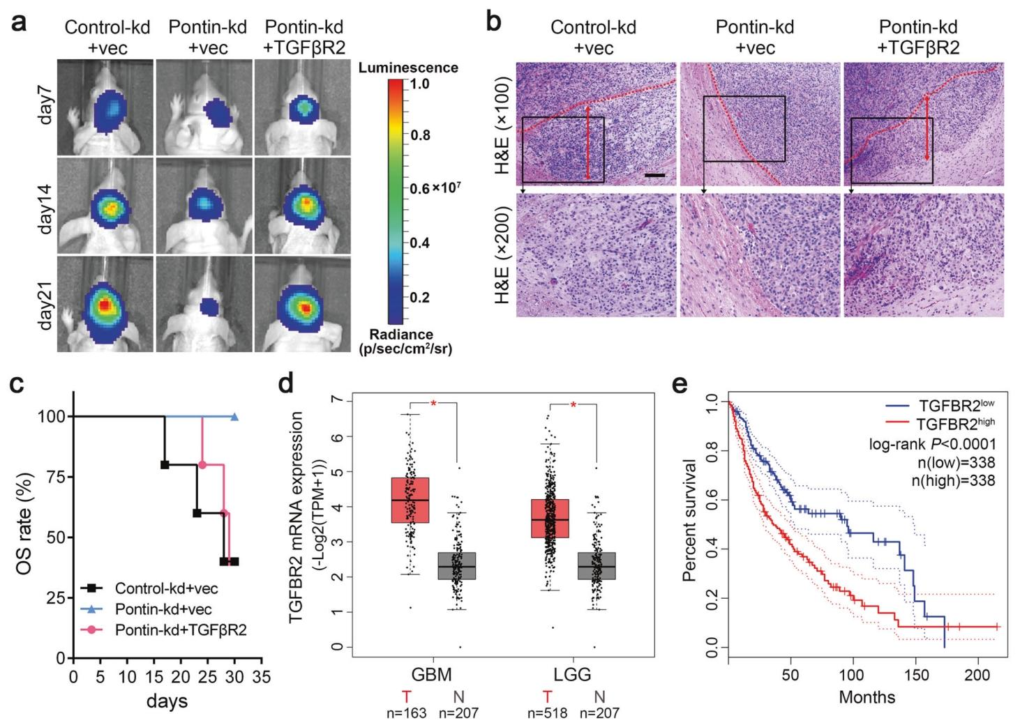 图8：TGFβR2 过表达恢复移植瘤生长且高表达提示预后不良