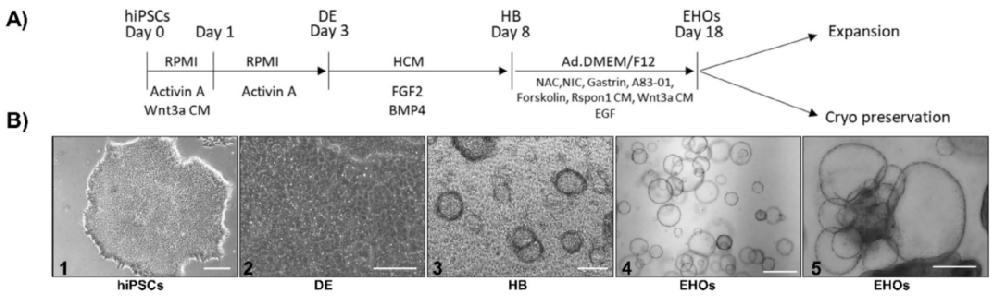图1 从iPSCs生成人类可扩展肝类器官(EHOs)的方案