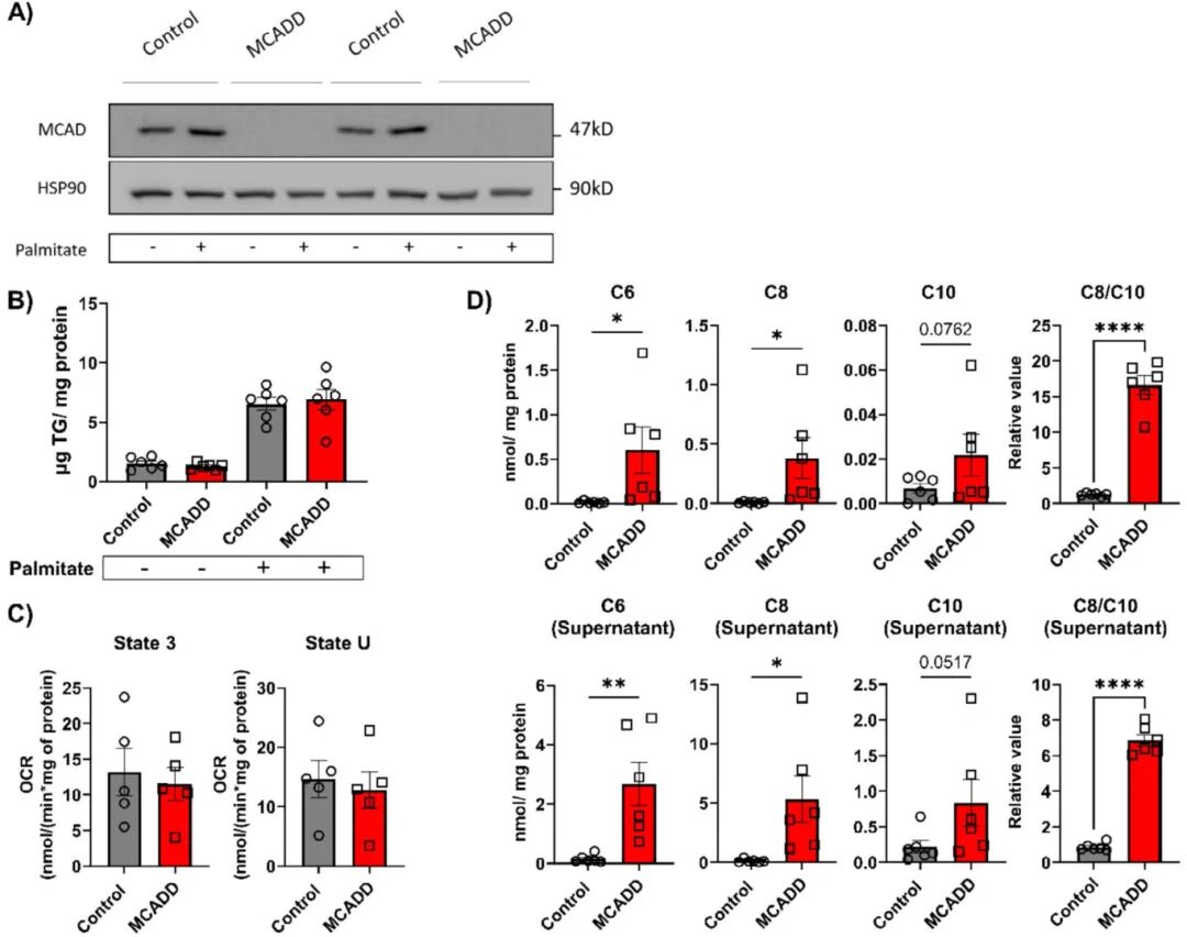 图3 MCADD EHO类器官在培养中表现出MCADD特征表型