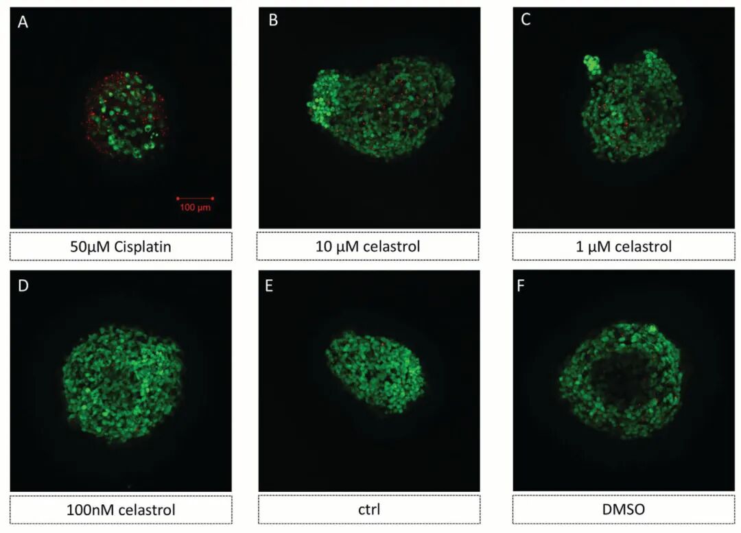 图2 3D肾类器官模型的代表性图像显示顺铂和雷公藤诱导肾毒性