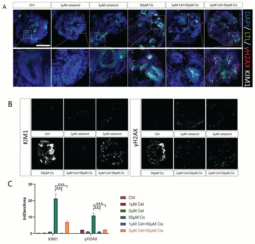 图3 雷公藤缓解肾小球和近端小管损伤