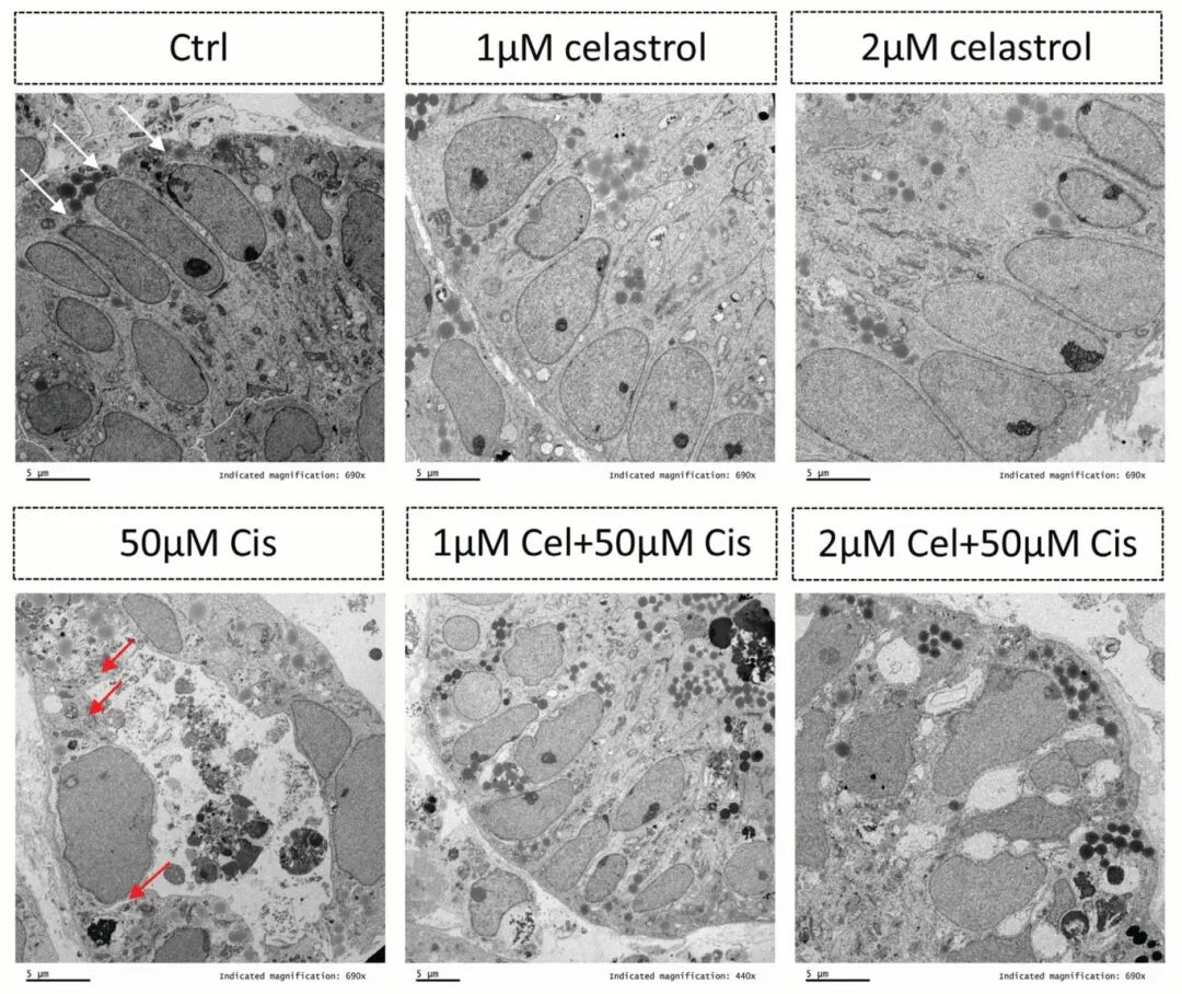 图4 透射电子显微镜显示肾脏器官内存在管状细胞