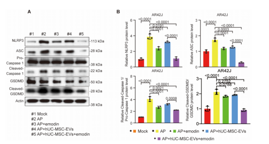 图2：喹啉增强人脐带间充质干细胞外泌体(hUC-MSC-EVs)在STZ处理的AR42J细胞中的抗焦亡功能。