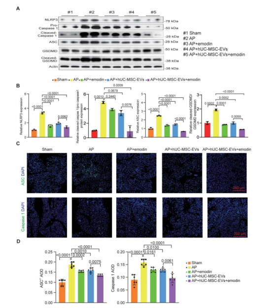 图6：埃莫丁增强人脐带间充质干细胞外泌体(hUC-MSC-EVs)对急性胰腺炎(AP)小鼠的抗细胞凋亡作用。