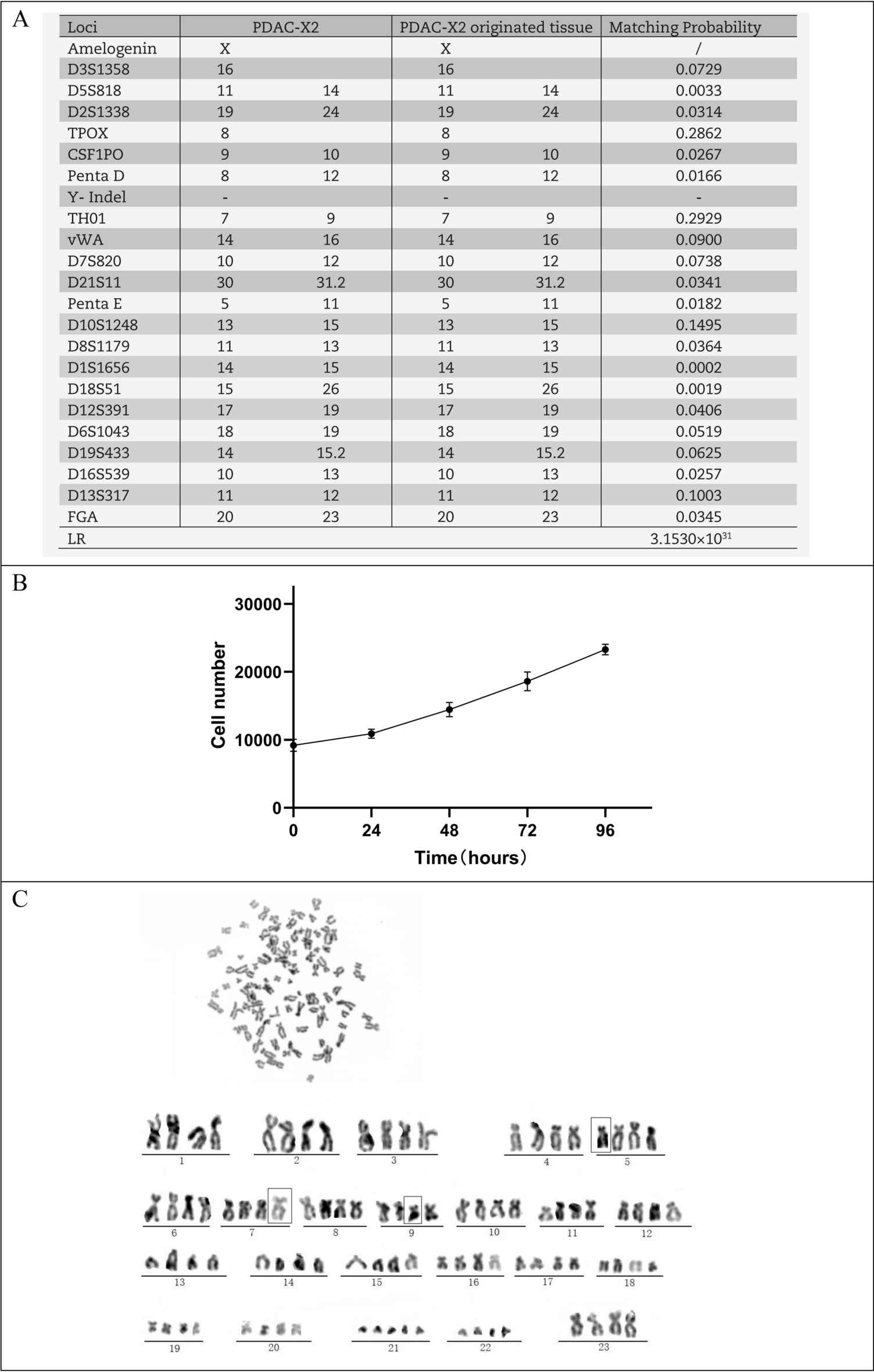 图2：PDAC-X2 的 STR 分型、生长曲线与核型