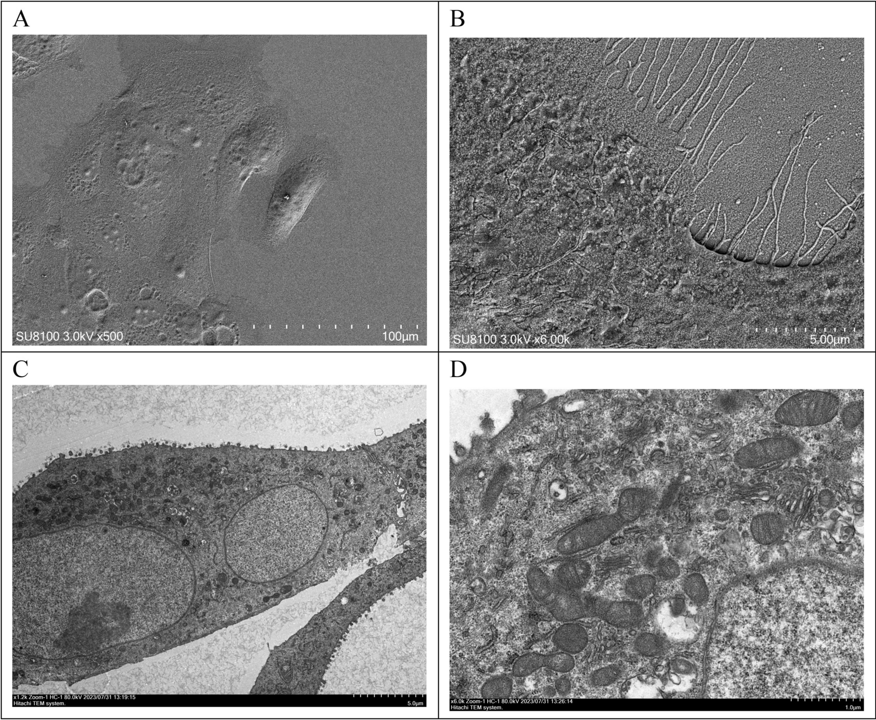 图3：PDAC-X2 的超微结构(SEM 与 TEM)