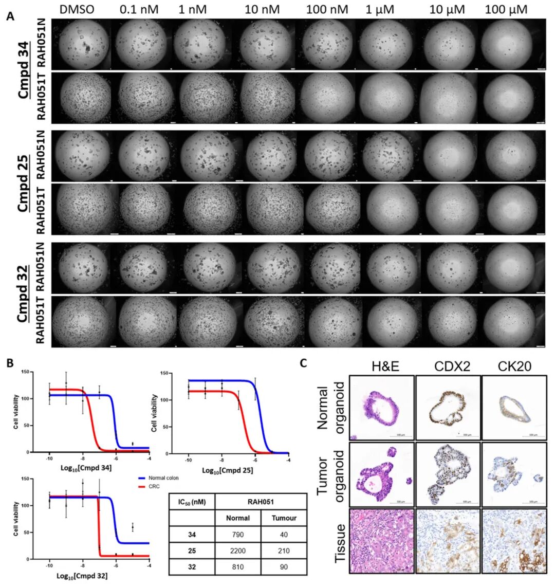 图3 与患者匹配的正常结肠类器官相比，CRC类器官对WEE1抑制剂的敏感性显著更高