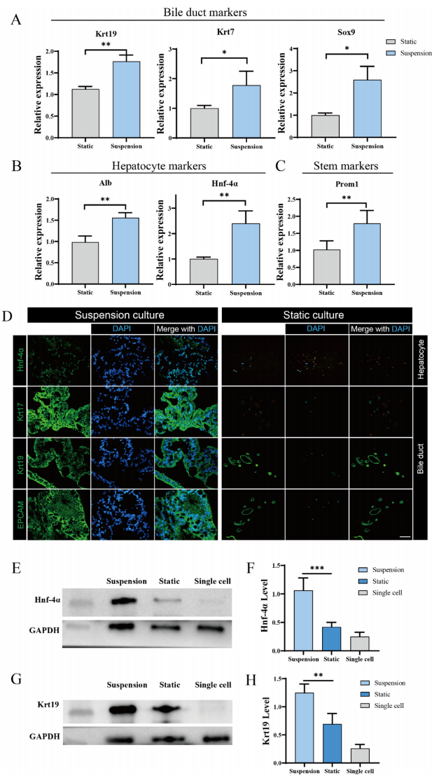 图 4 通过 qPCR 和免疫荧光分析，比较了悬浮培养和静态培养条件下肝胆管类器官的分化水平和干细胞特性。