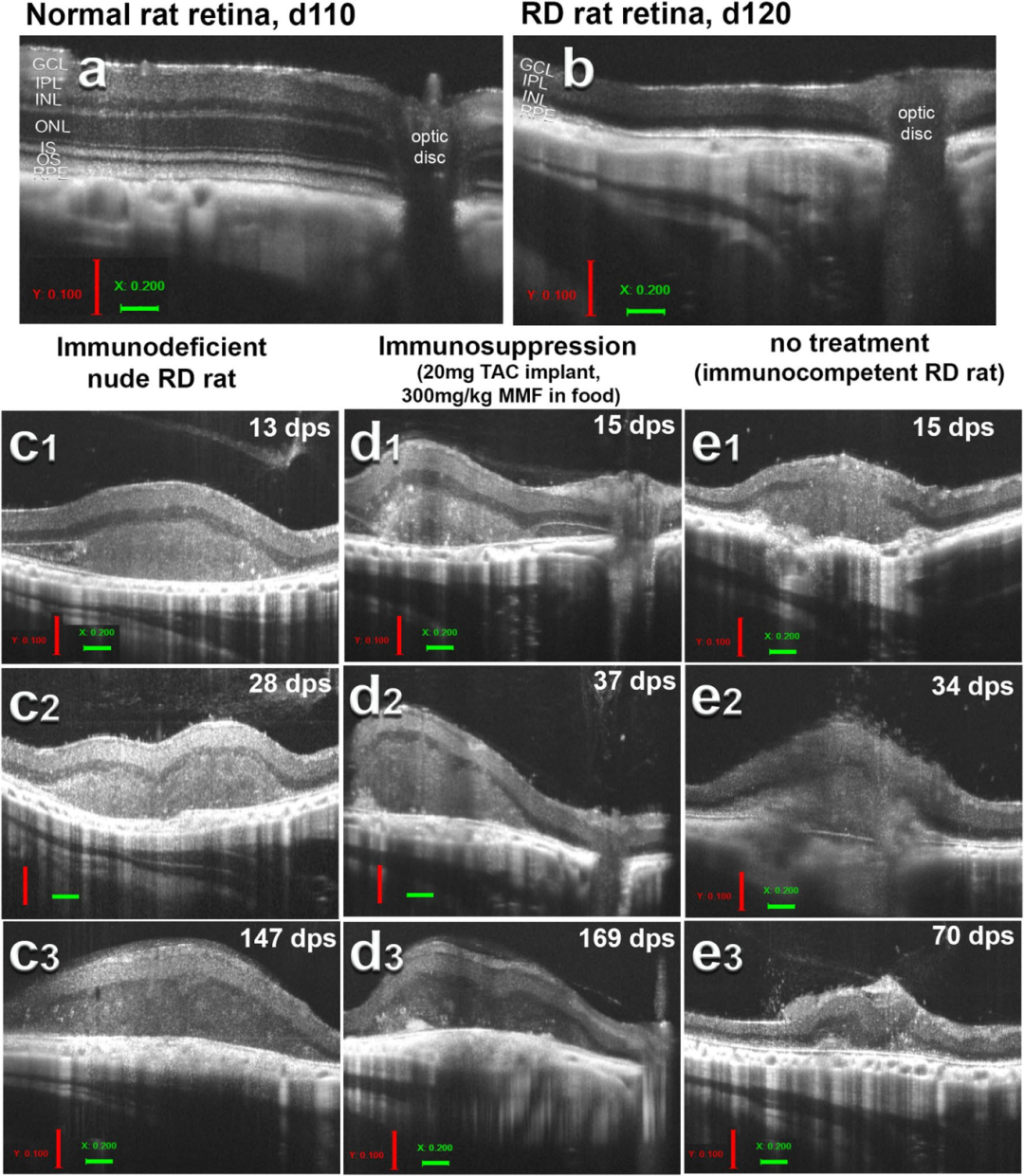 4，体内移植后视网膜类器官的长期存活与形态学评估