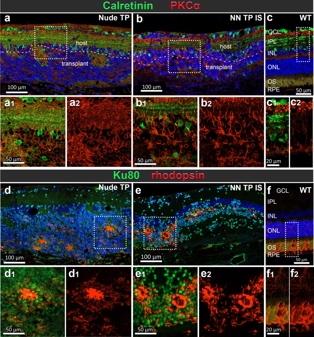 7，移植物在宿主视网膜中的结构整合