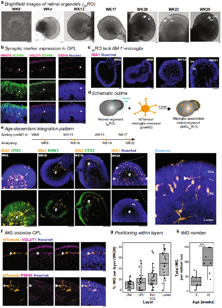 1,微胶质细胞在视网膜类器官中的整合