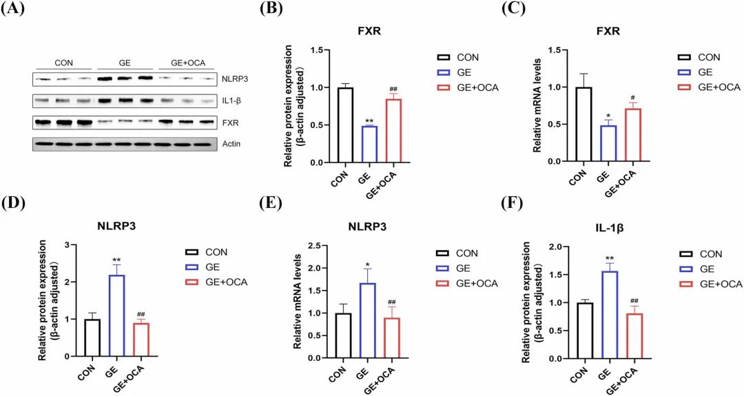 图3：GE 通过抑制 FXR 激活 NLRP3 炎性小体
