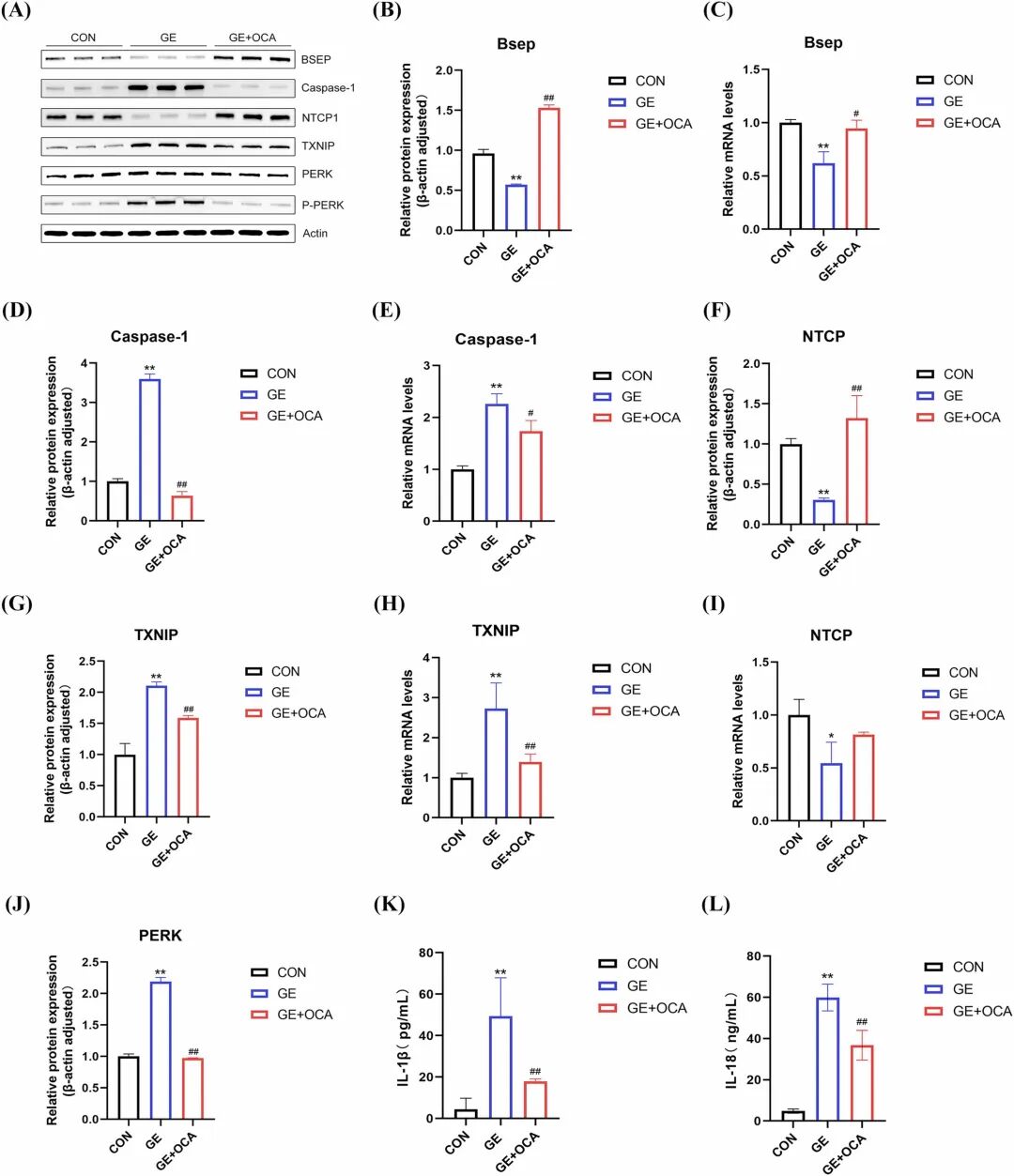 图4：GE 通过 PERK/TXNIP 通路调控 NLRP3，OCA 逆转该过程