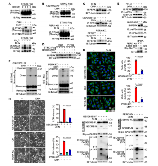 图7：DHN诱导的PERK介导的sting磷酸化促进了sting的聚合。黑色素瘤A375细胞经DHN(15μM)处理12小时以检测sting磷酸化、内质网中的sting斑点、sting聚合体以及TI中各种蛋白质的位置;经20小时处理以评估焦亡特征，除非另有说明。