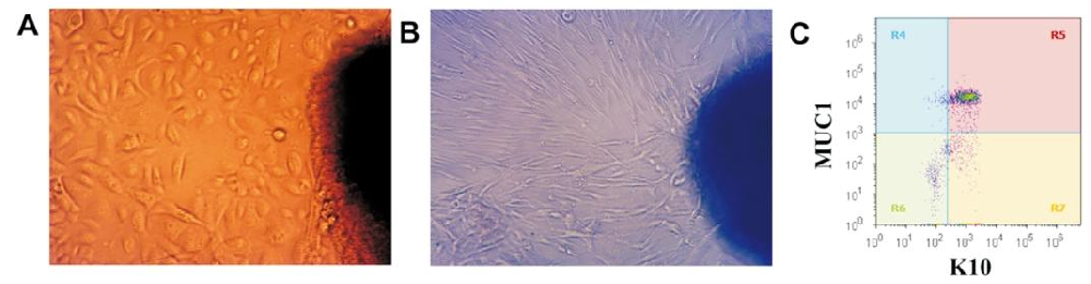 图1：人翼状胬肉原代细胞的鉴定