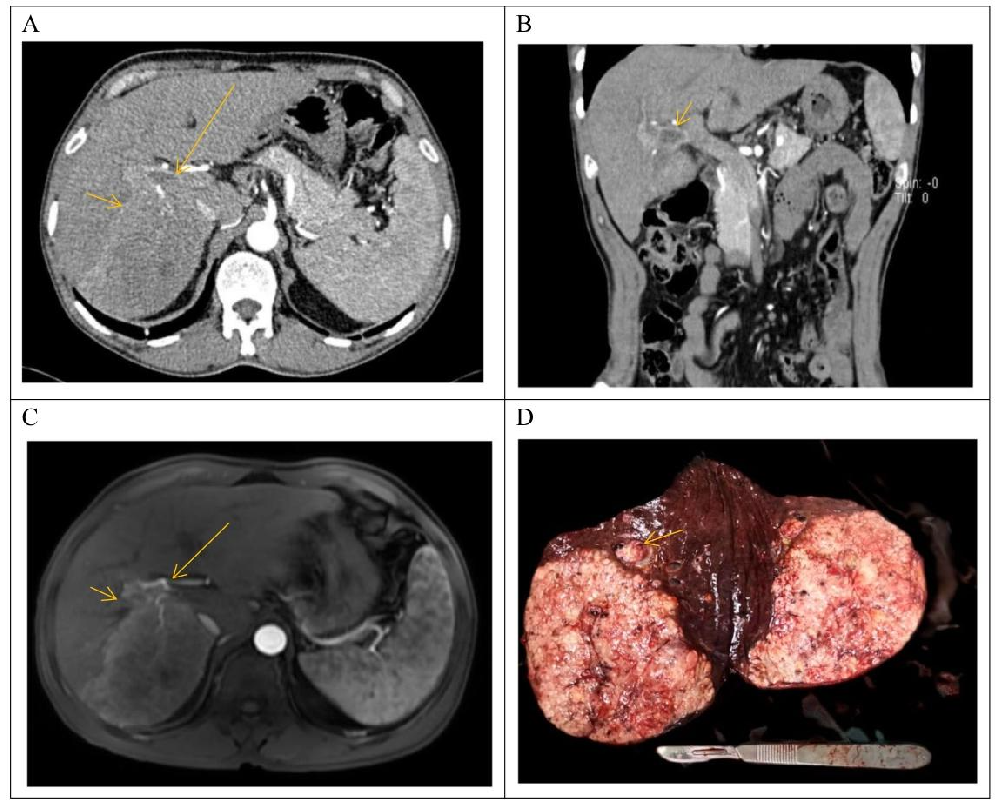 图1：患者临床资料