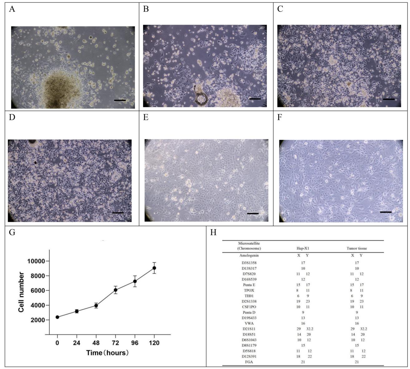 图3：Hep-X1细胞培养过程、生长曲线与STR分型