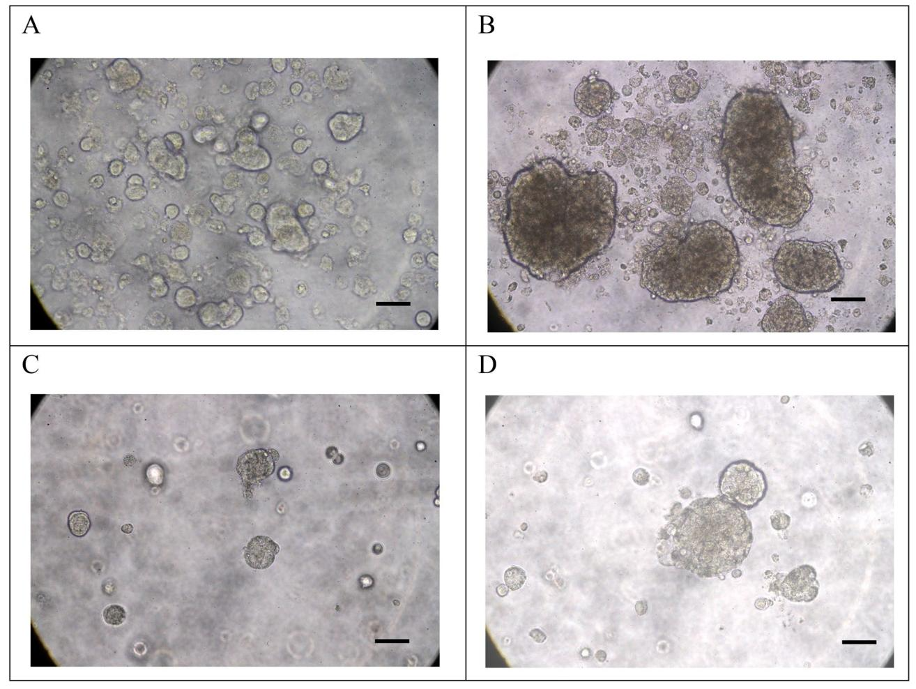 图4：Hep-X1的球形成与类器官培养