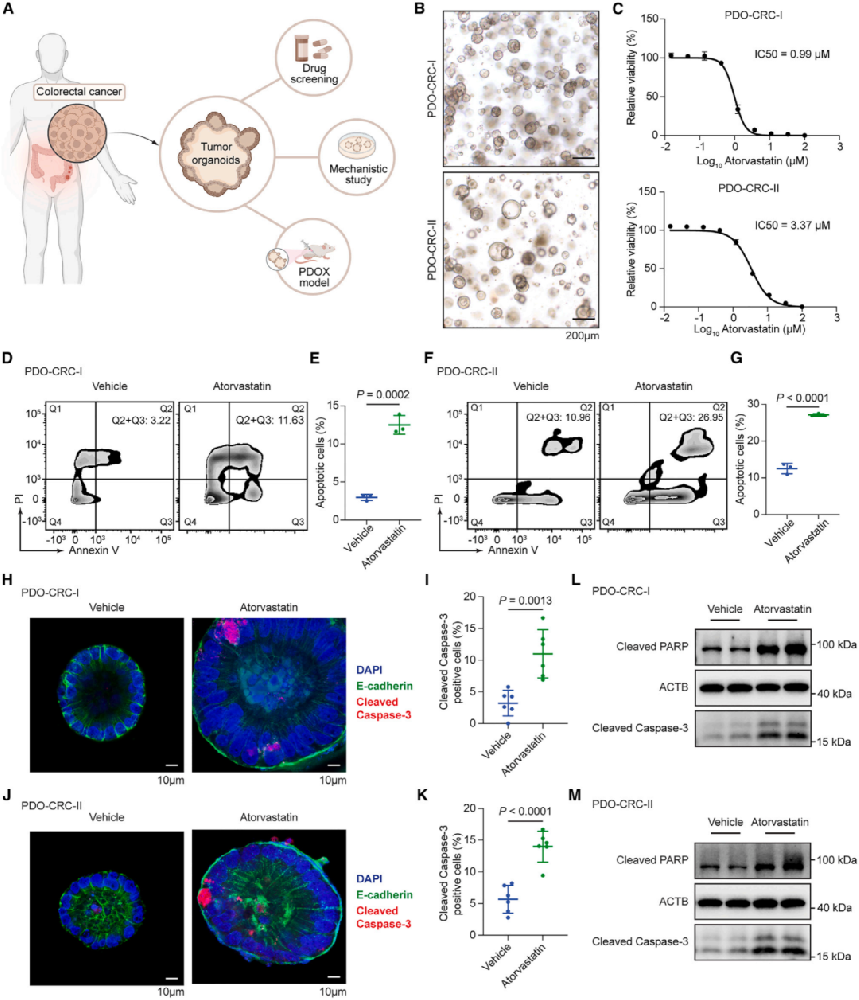 1，他汀类药物在结直肠癌PDOs中发挥抗癌作用
