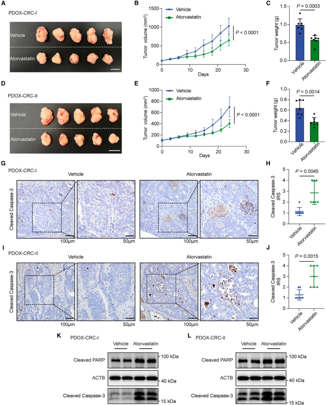 2，他汀类药物在PDOX模型中抑制结直肠癌