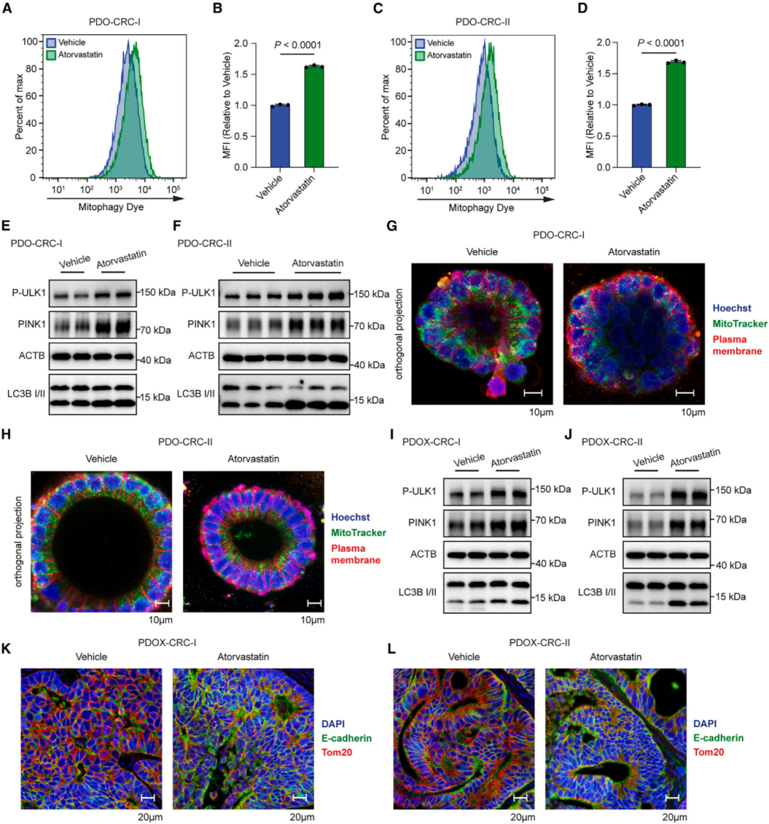 4，结直肠癌对他汀治疗做出线粒体自噬反应