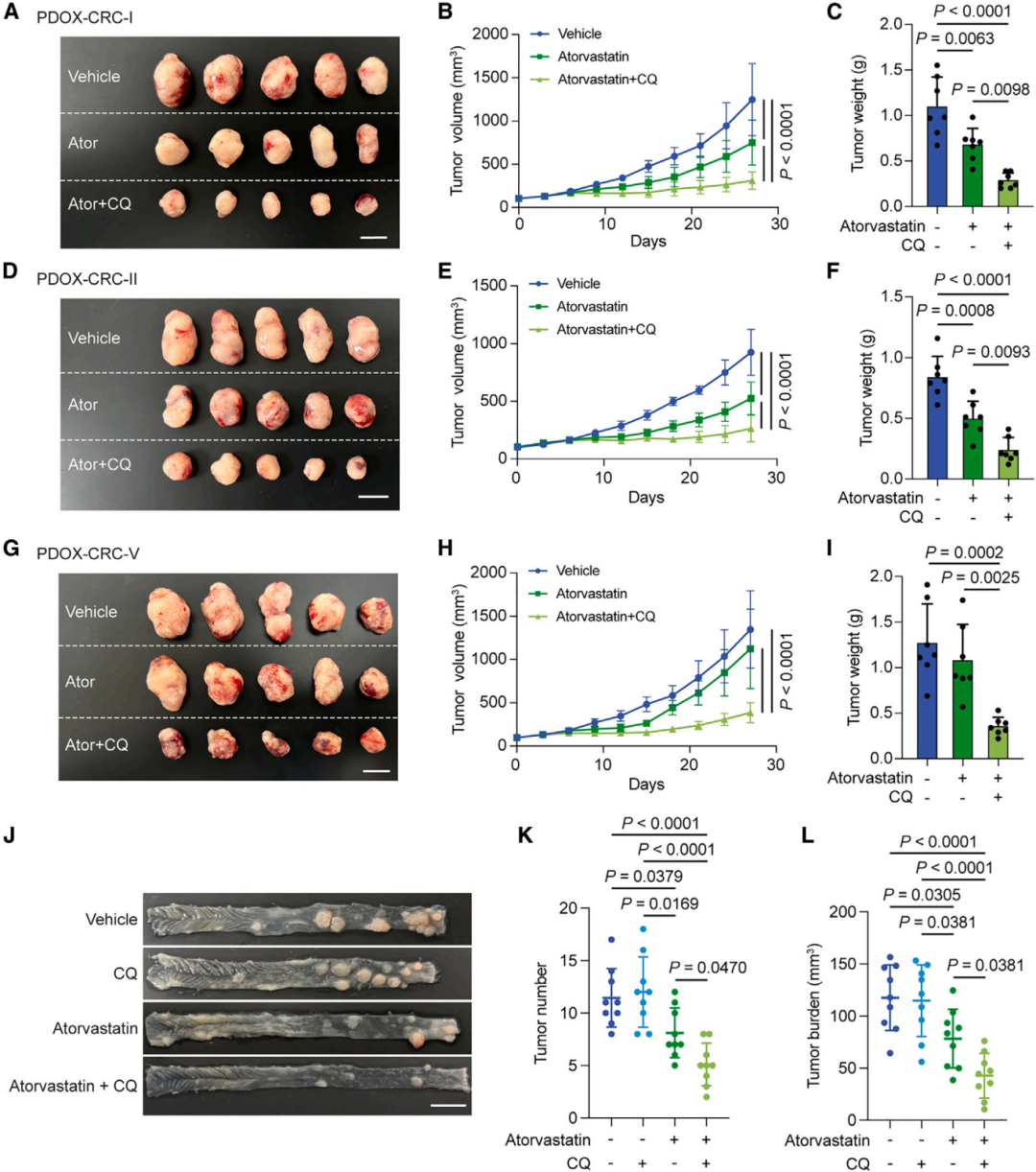 6，联合他汀和氯喹的治疗在体内展现增强的抗癌效果