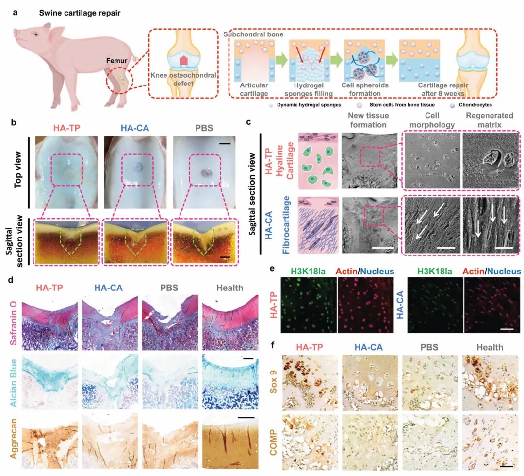 图6 无细胞超动态水凝胶显著增强了猪骨软骨缺损中透明软骨和软骨下骨的原位再生