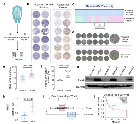 图1：CuOTeDsP纳米平台的合成与肿瘤抑制机制