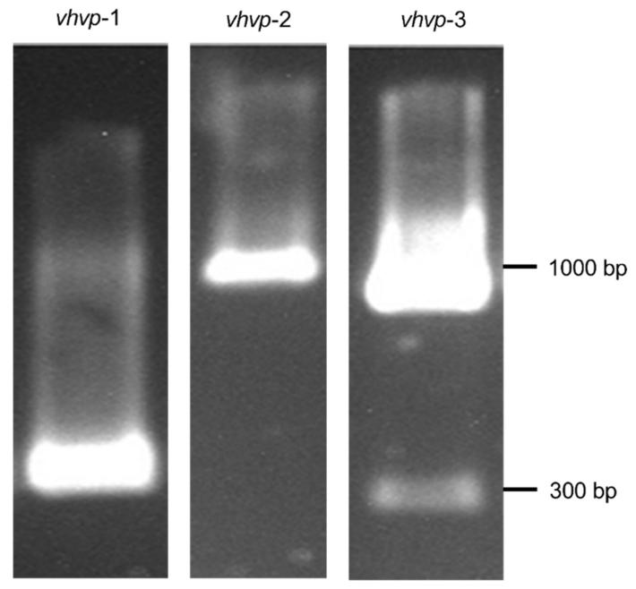 图 1：VpTPD 毒力基因的 PCR 鉴定