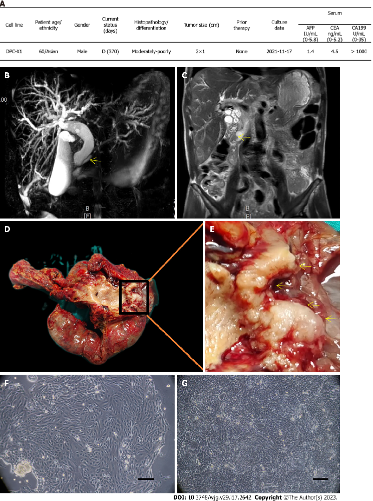 图1：患者临床资料与 DPC-X1 细胞形态