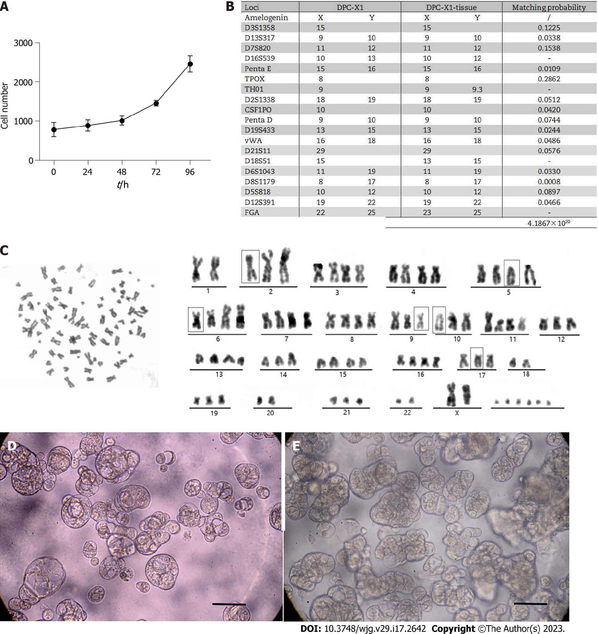 图2：DPC-X1 的生长曲线、STR 检测、核型分析及类器官培养