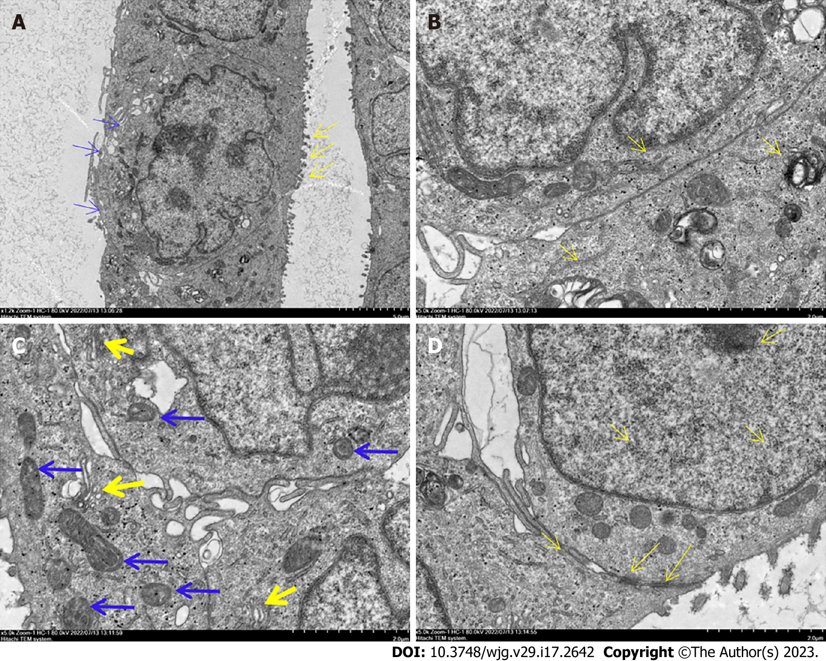 图3：DPC-X1 的透射电镜超微结构