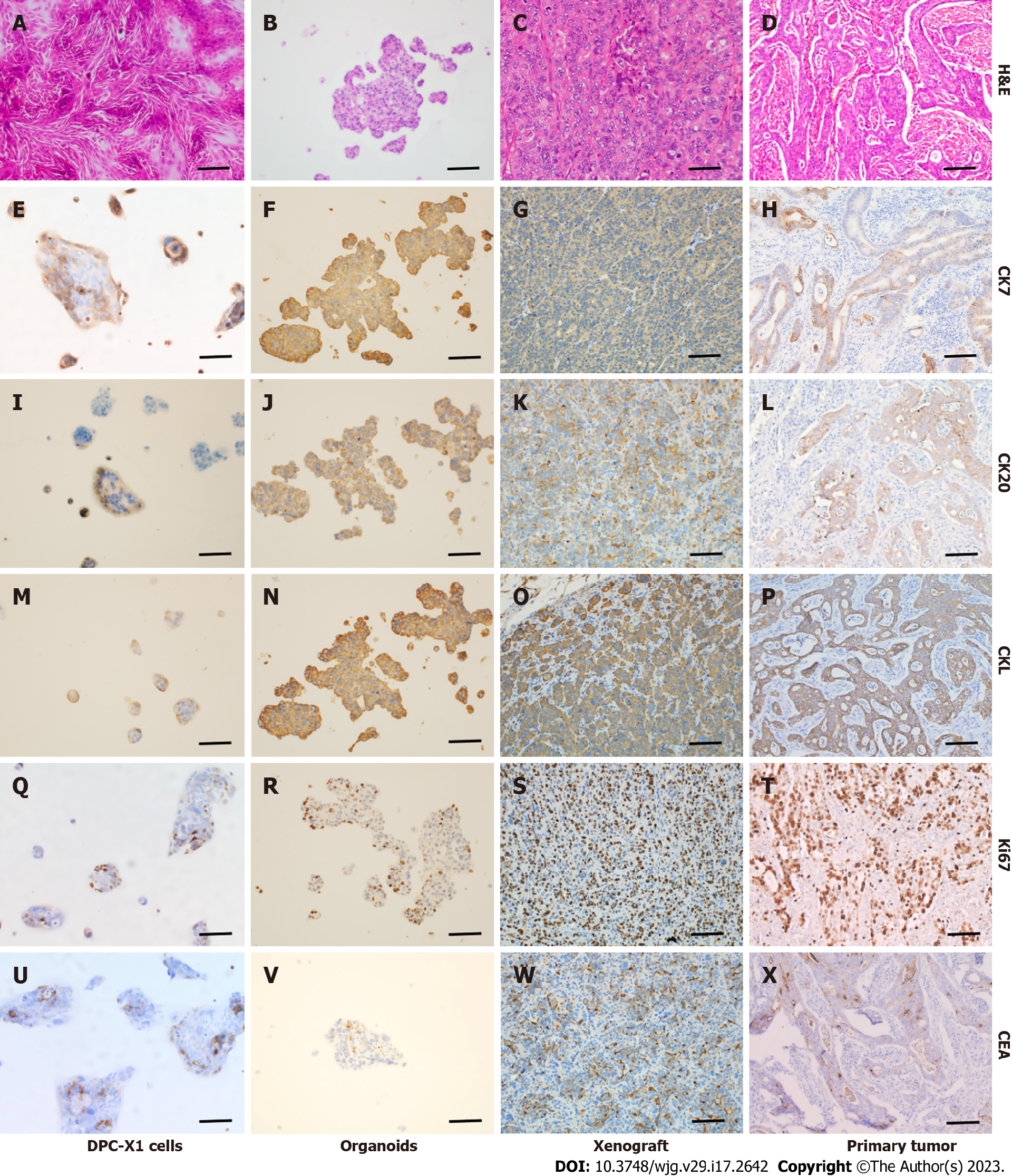 图6：DPC-X1 的 HE 染色与免疫组化特征