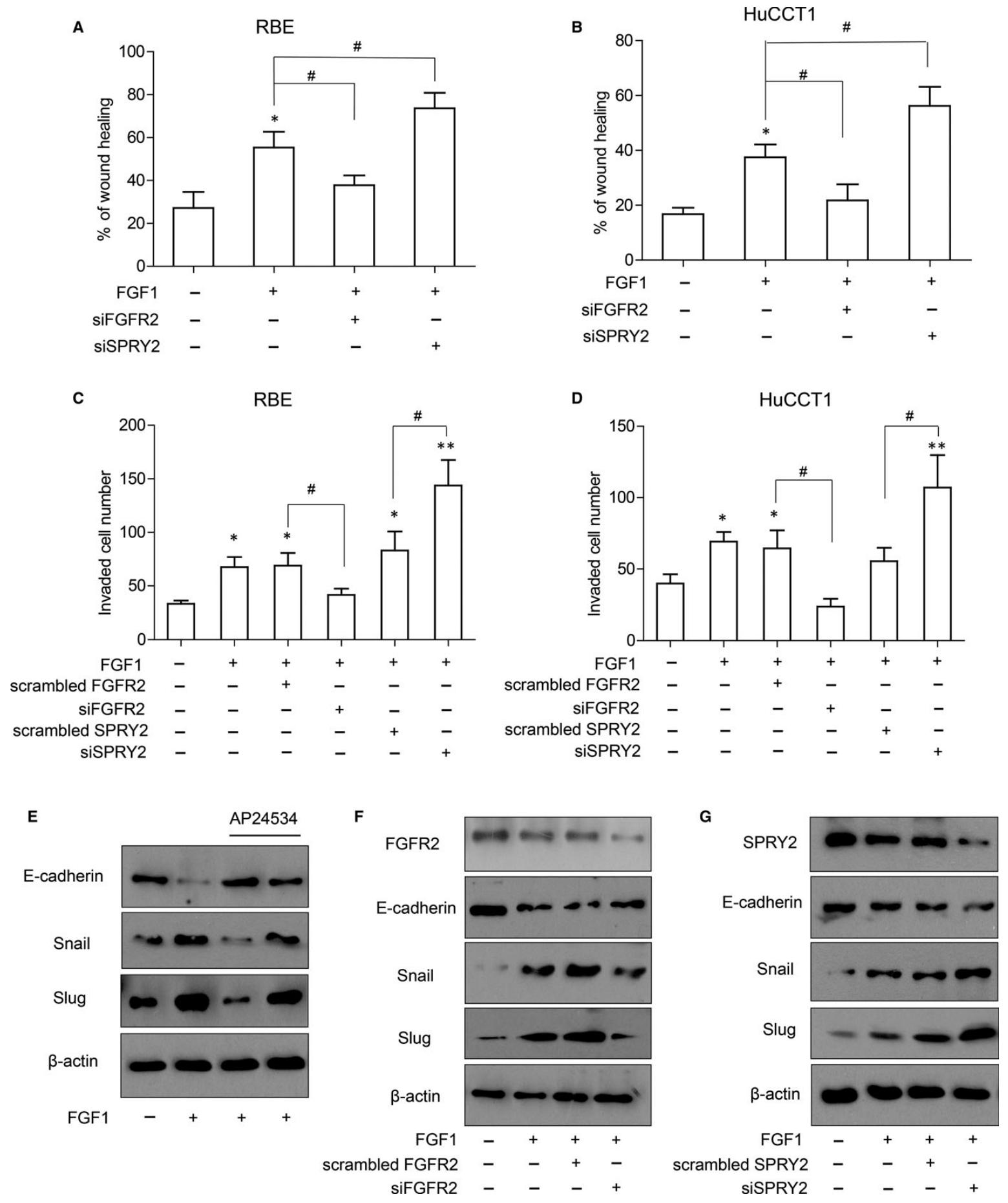 图5：SPRY2 抑制 FGFR2 诱导的 ICC 细胞迁移侵袭及 EMT