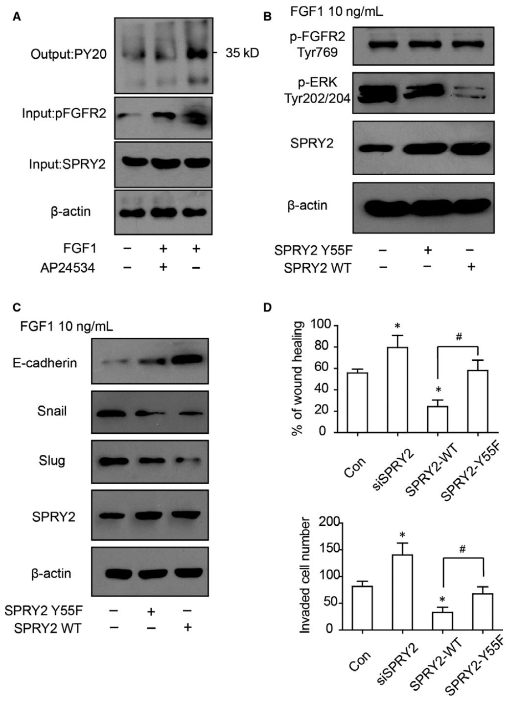 图6：SPRY2-Y55 磷酸化对其抑癌功能至关重要