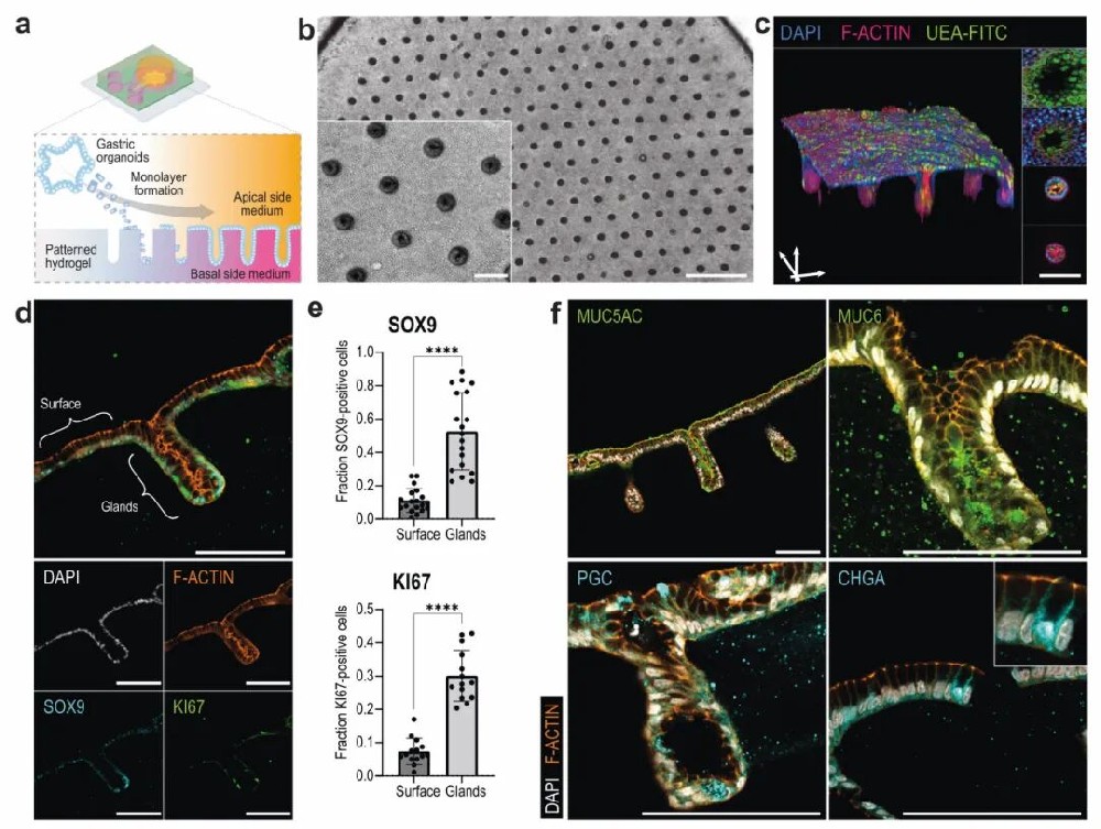 图1 腺体模式胃上皮模型的建立