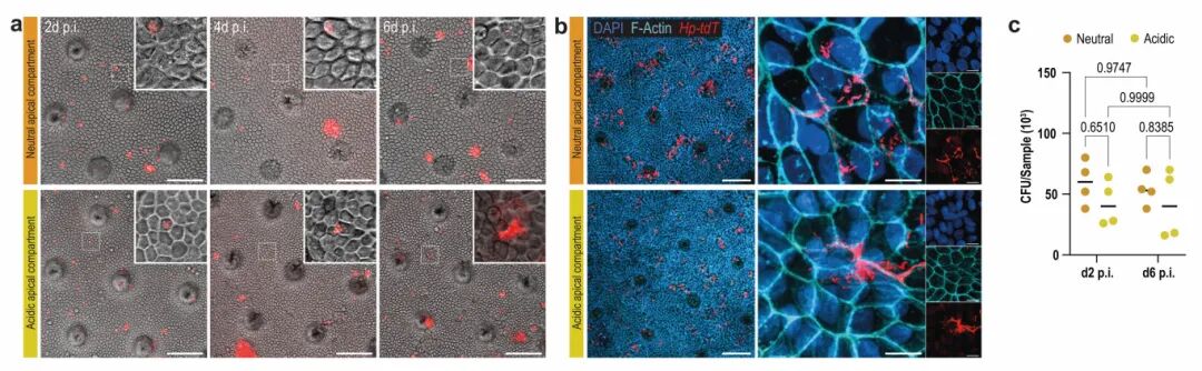 图2 幽门螺杆菌感染