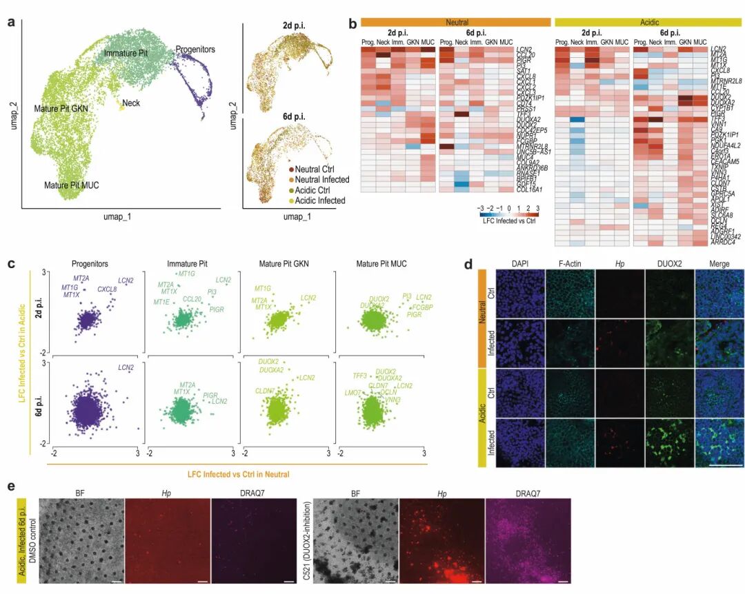 图4 幽门螺杆菌感染样本的特异性反应显示细胞型