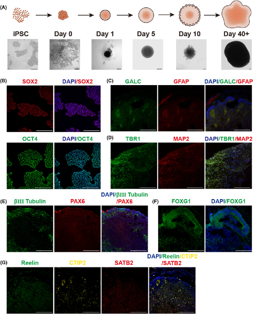 图1展示了从人类诱导多能干细胞(iPSCs)生成脑类器官的过程。