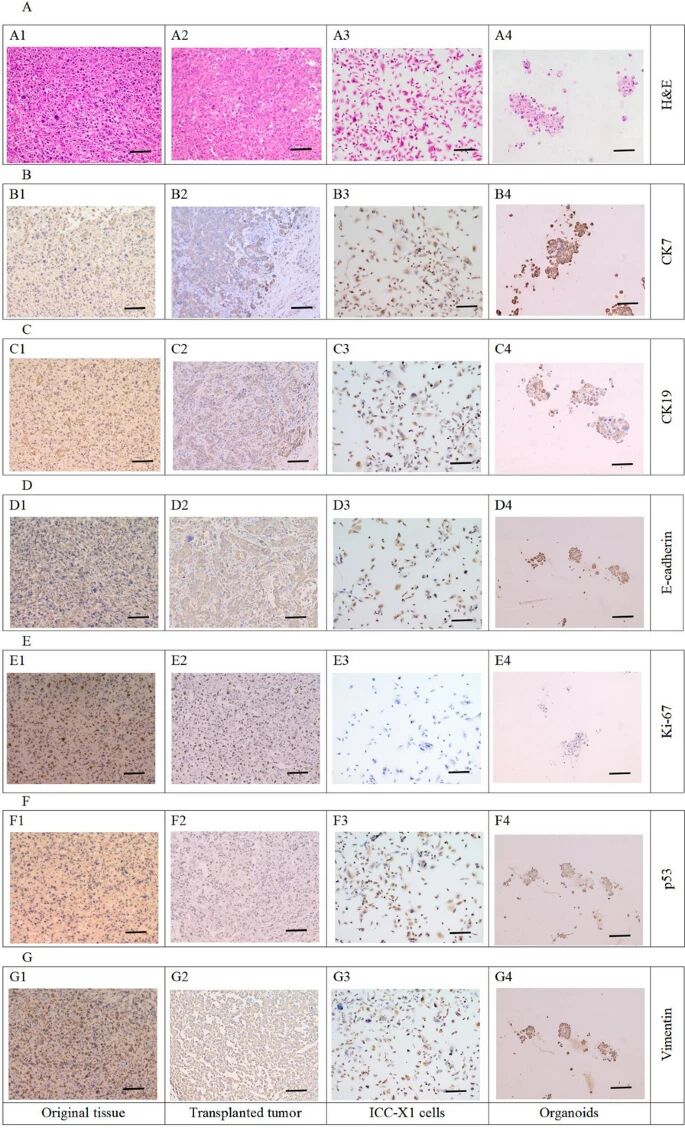 图5：ICC-X1 及衍生模型的组织病理与免疫表型