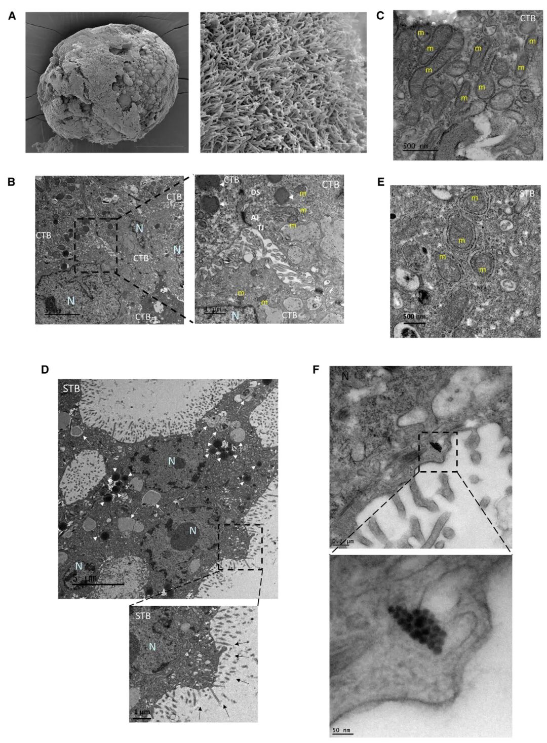 图2 滋养层类器官中CTB和STB的超微结构