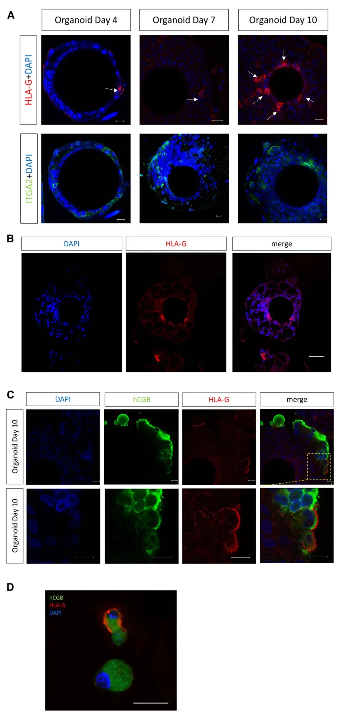 图3 滋养层类器官中HLA-G的表达