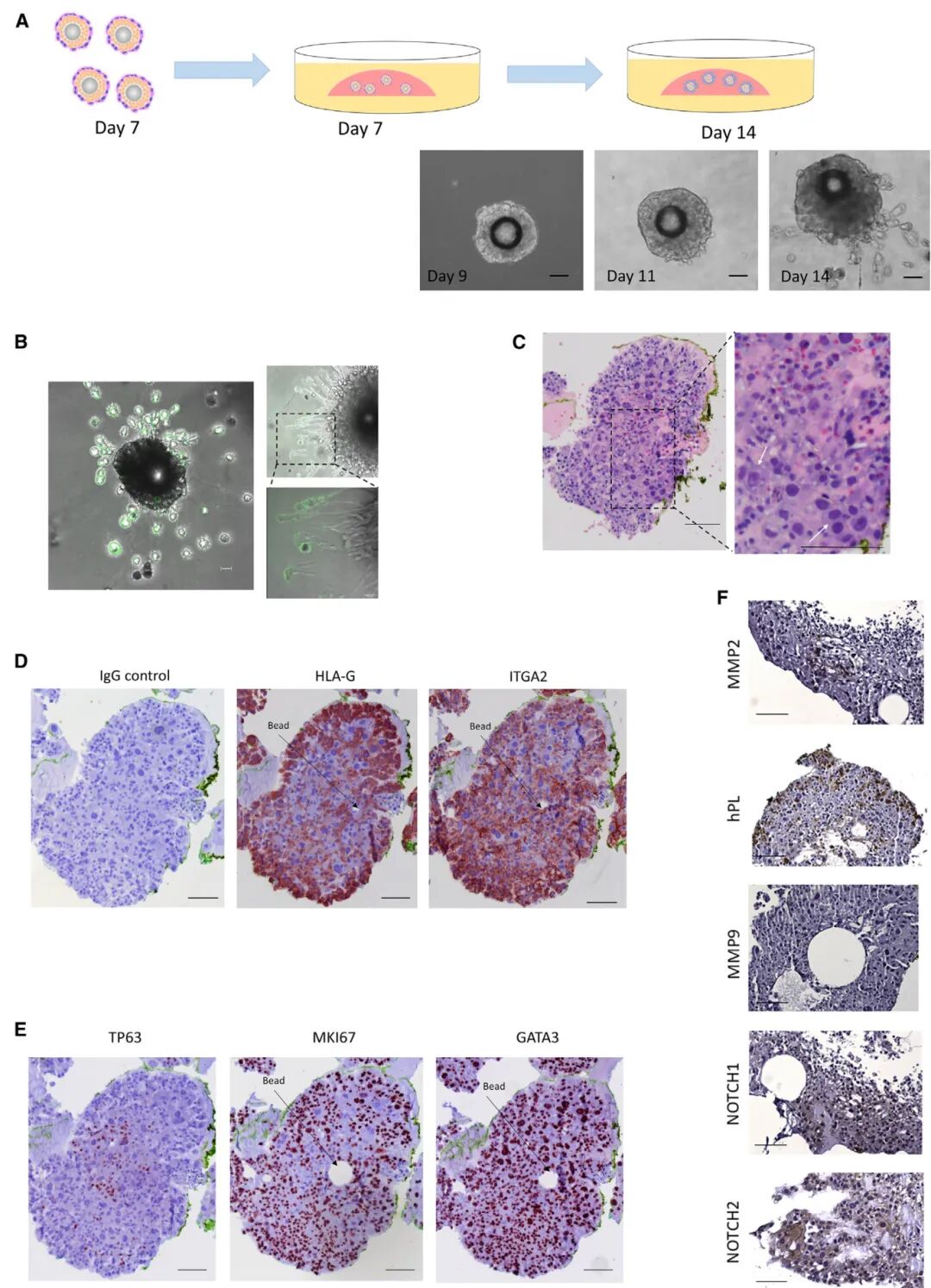 图4 从滋养层类器官中产生迁移性和侵袭性的HLA-G+EVT样细胞