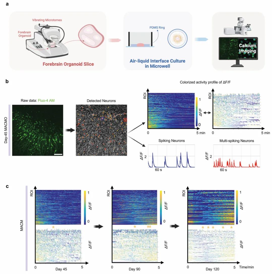 图3 钙成像显示了前脑类器官的功能活动