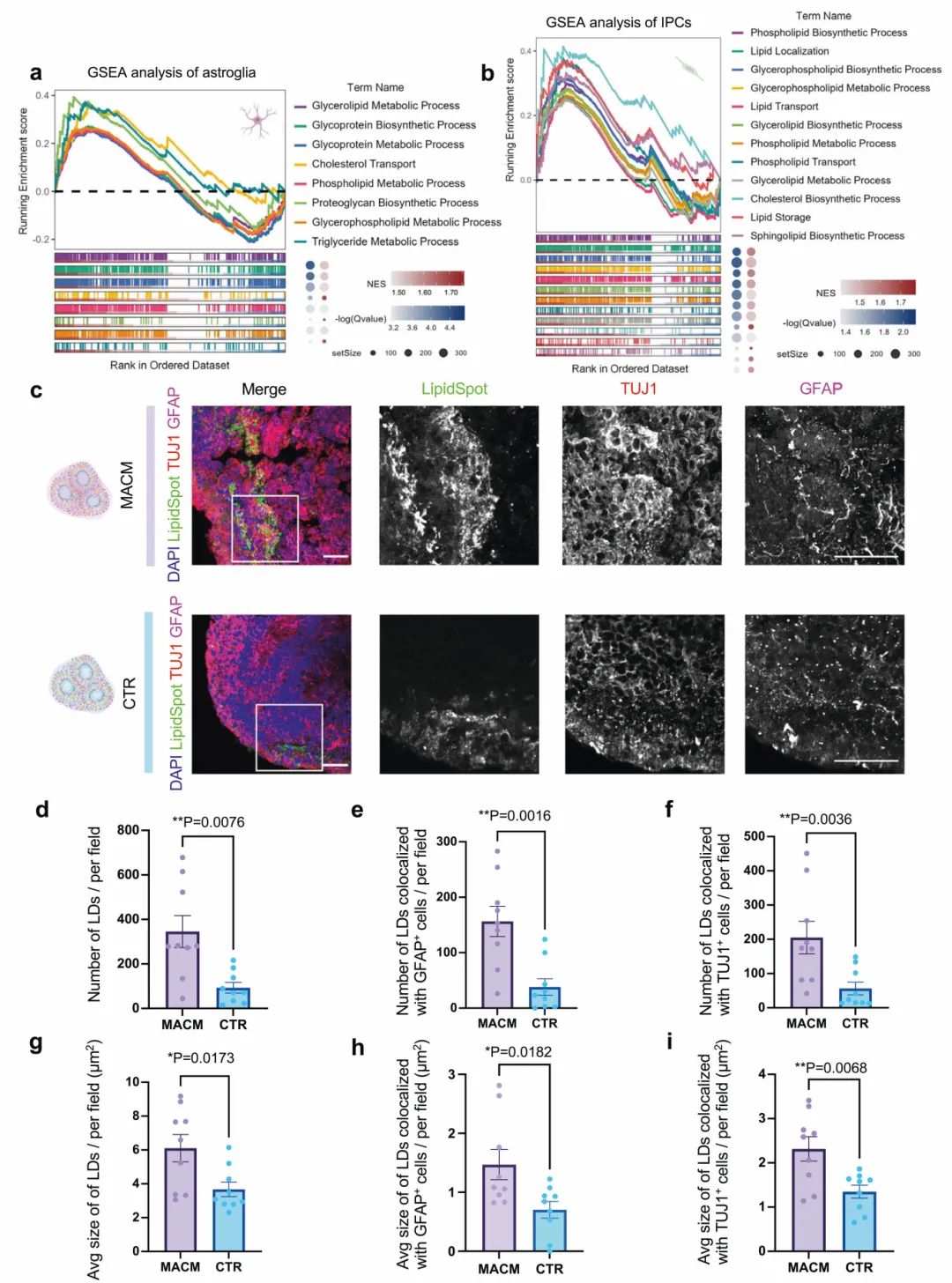 图6 ACM培养可提高类器官的神经元和星形胶质细胞中的脂滴水平