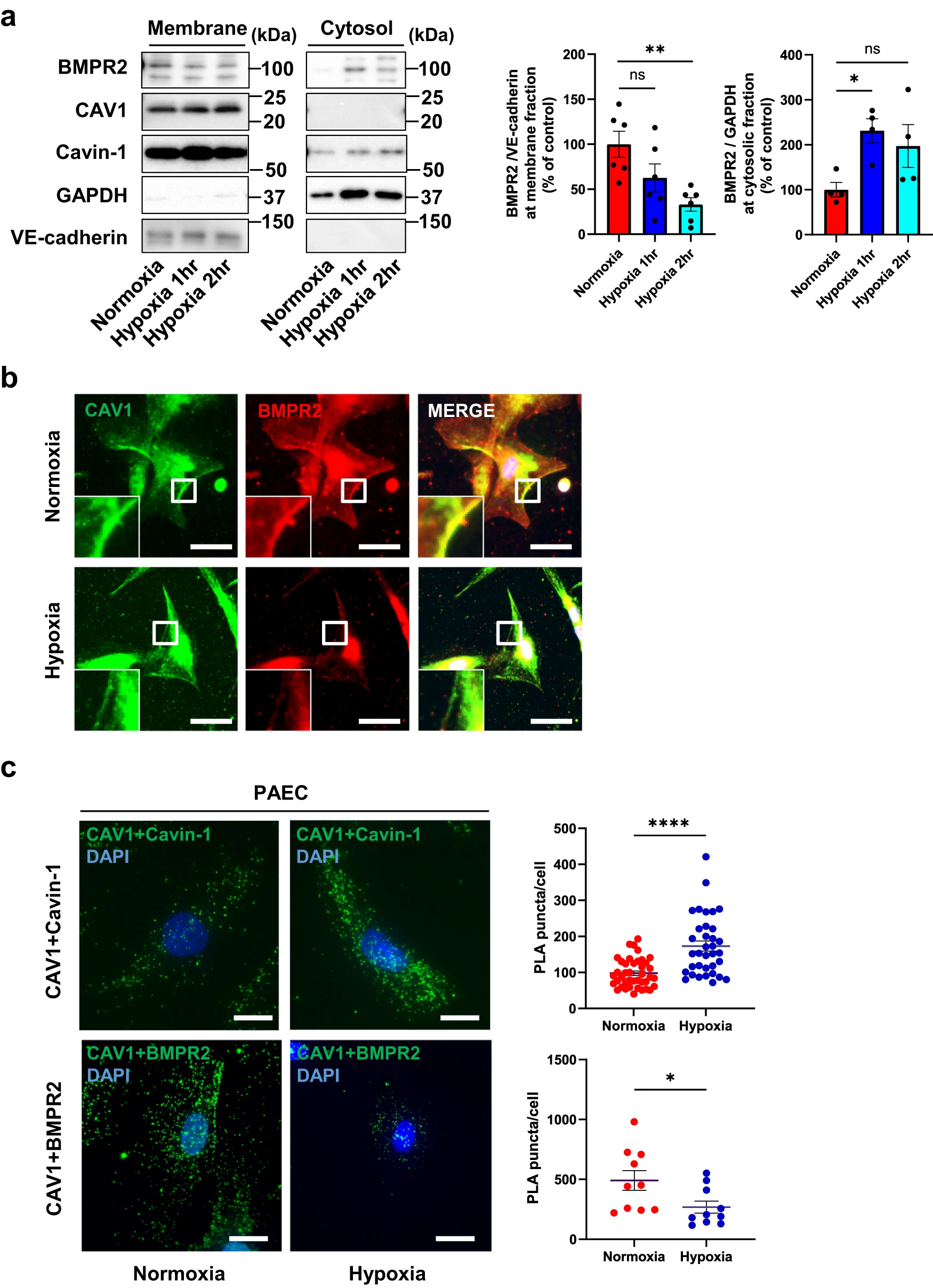 图 3：缺氧增强 Cavin-1/CAV1 相互作用，抑制 CAV1/BMPR2 结合