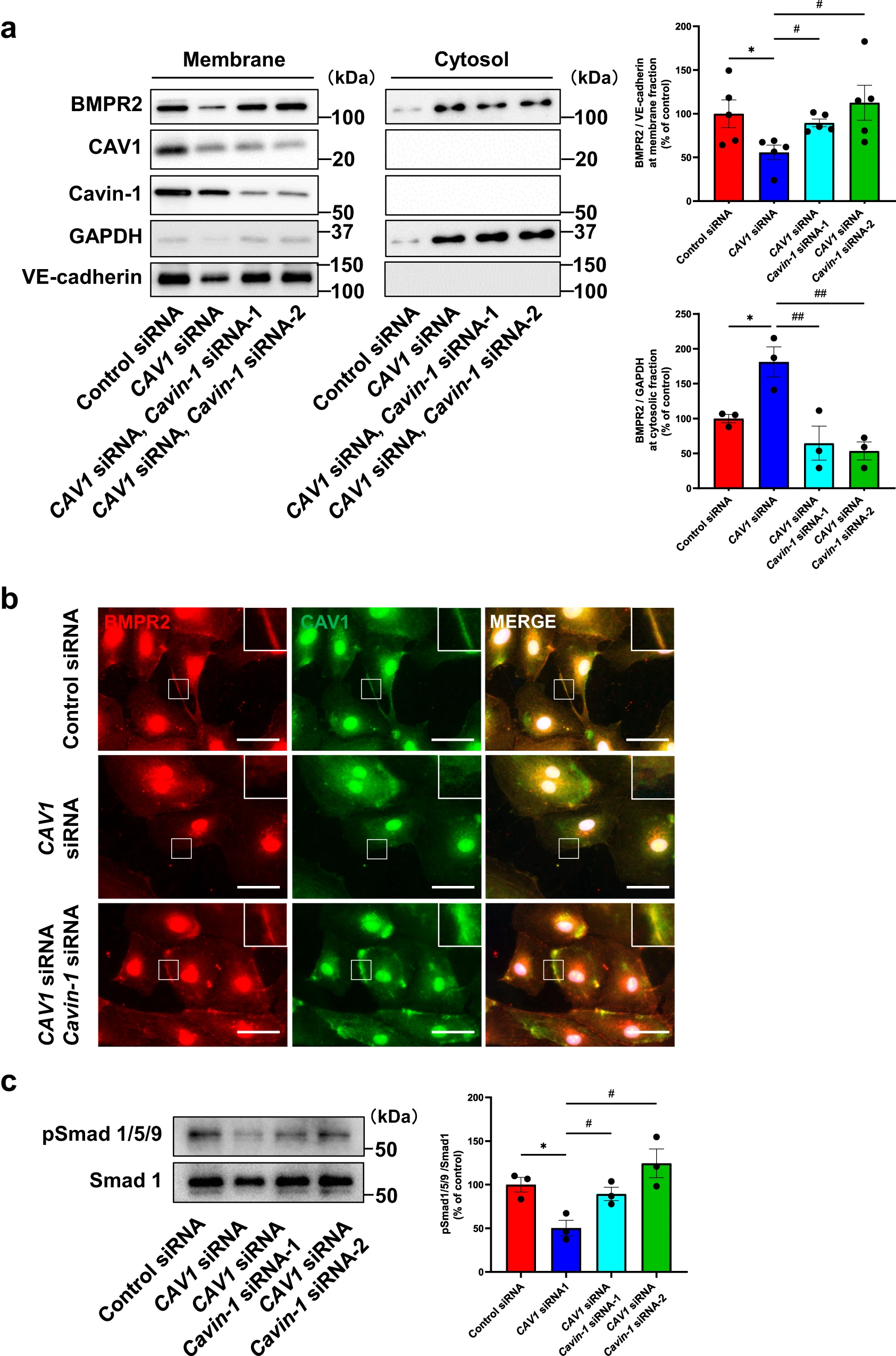 图 5：Cavin-1沉默挽救CAV1沉默导致的 BMPR2 膜定位及 Smad 信号减弱