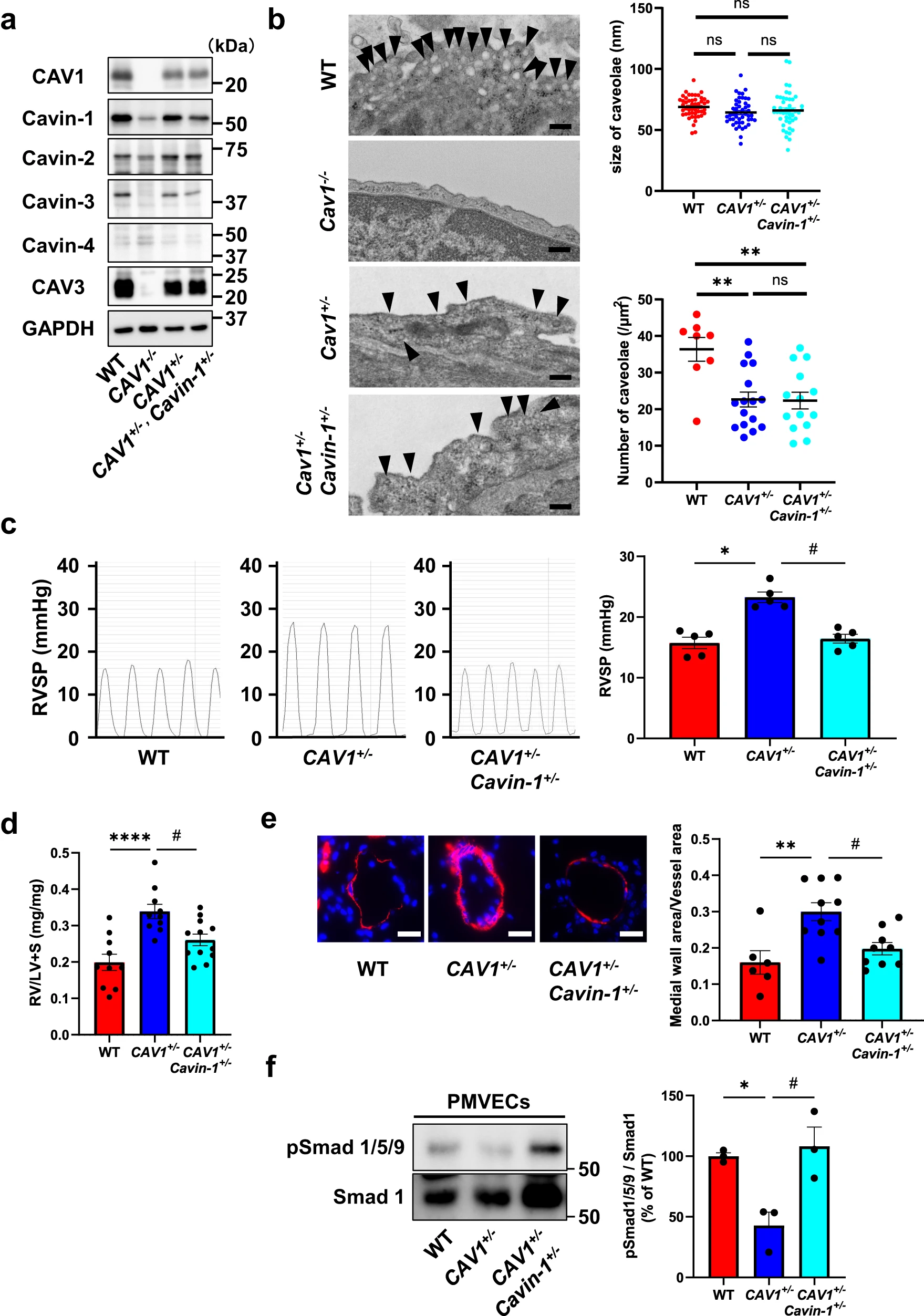 图 6：CAV1⁺/⁻/Cavin-1⁺/⁻双杂合小鼠抵抗 CAV1 诱导的 PAH