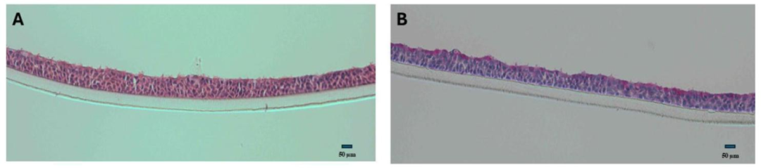 图 4：H&E 与 PAS 染色的组织学结果