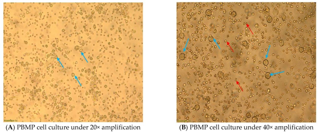Fig3：PBMP 细胞形态特征(培养 48h 后)
